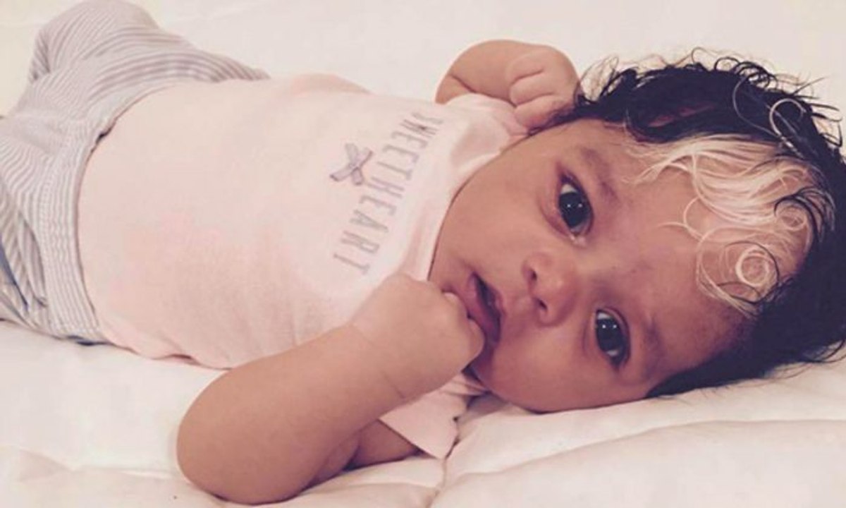 Ce bébé est né avec une mèche blanche mais quand vous allez voir sa maman vous allez comprendre