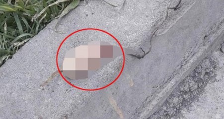 Korkunç! Sokakta Oyun Oynayan Çocuklar 3 Kesik Parmak Buldu