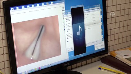 Ses kısıklığı tedavisi için oral maske üretti - İZMİR