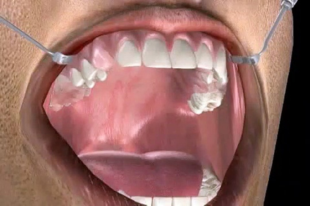 was ist die zahnärztliche Prothetik