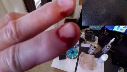 Points de sutures, voici ce que cela fait réellement !