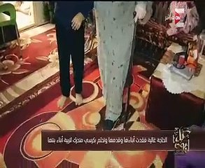 معاناة سيدة أجرت أكثر من 30 عملية جراحية وتحتاج المزيد