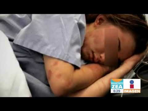 Joven karateca golpea salvajemente a su novia en Yucatán | Noticias con Francisco Zea