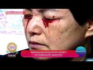 Casos sin Respuesta: ¿personas que lloran sangre? | Sale el Sol