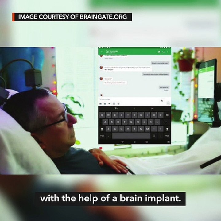 Brain implant lets people with paralysis perfor...
