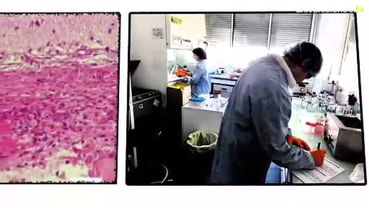 Bioprinting