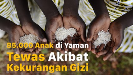 Tragis! Ribuan Anak di Yaman Tewas Akibat Malnutrisi