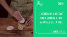 Remedios para eliminar las manchas en la piel