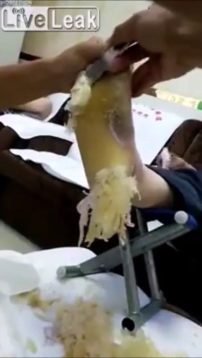 Il a beaucoup de corne sous les pieds... Horrible