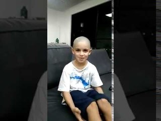 Alopecia Areata: crianças mostram que a amizade contribui na luta contra a doença