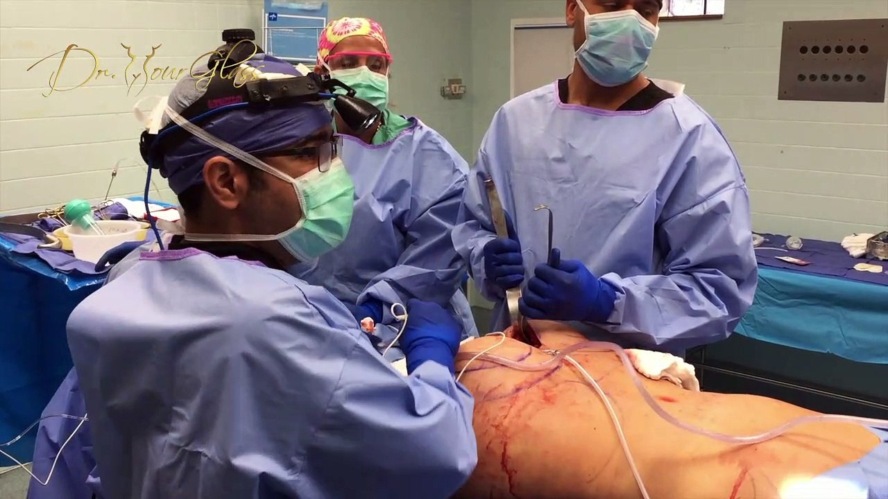 Abnormal scarring after buttock implant surgery