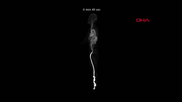 ABD Tıpta Çığır Açacak Görüntüleme Cihazı