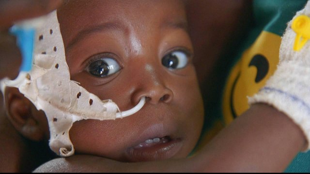 Central African Republic's 45,000 children at risk of starvation - UNICEF