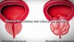 Jengibre-capacez-de-destruir-el-cancer-de-colon-prostata-y-ovarios