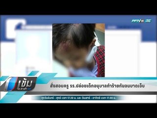 สั่งสอบครู รร.ปล่อยเด็กอนุบาลทำร้ายกันจนบาดเจ็บ - เข้มข่าวค่ำ