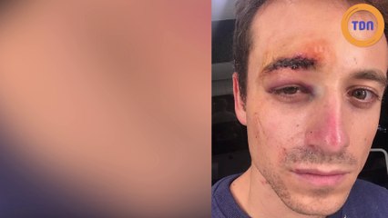 Hugo Clément raconte son calvaire lors d'une manifestation des "gilets jaunes" à Paris !