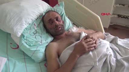 Kocaeli 250 Tonluk Çöken Viyadüğün Altından Bacağı ve Kaburgaları Kırılarak Kurtuldu