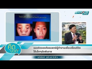 คิดบวก - แนวคิดของศัลยแพทย์ผู้ทำงานเพื่อเปลี่ยนชีวิตให้เด็กๆนับพันราย 1/2
