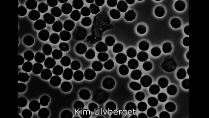 Video of Blood Under A Microscope - Immune System Hunting In Blood
