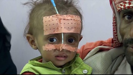 Yemenis 'pray' upcoming talks will end war