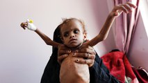 الأمم المتحدة تخشى خسارة معركتها مع الجوع باليمن