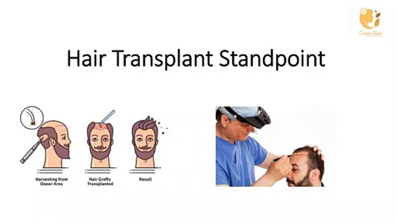 Hair Transplant Standpoint