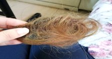 Hasta Yakını Genç Kız, Sağlık Çalışanını Darp Edip Saçını Kopardı