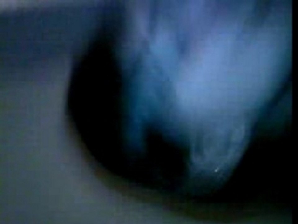 SV_A0046
