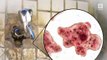 Doctors Say Tap Water in Neti Pot Caused Fatal Brain-Eating Amoeba