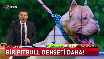 Pitbull saldırırsa ne yapmalı?