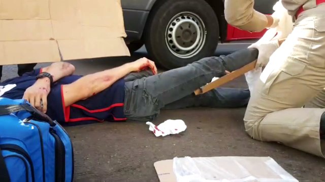 Motociclista fica ferido ao bater na traseira de carro