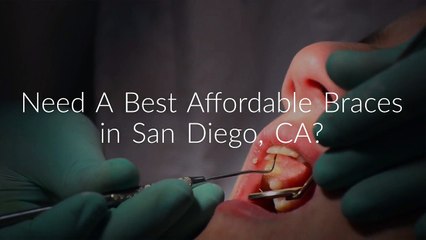 Dr. Melanie Affordable Braces in San Diego, CA