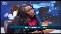 Treatment Options For Hyperhidrosis