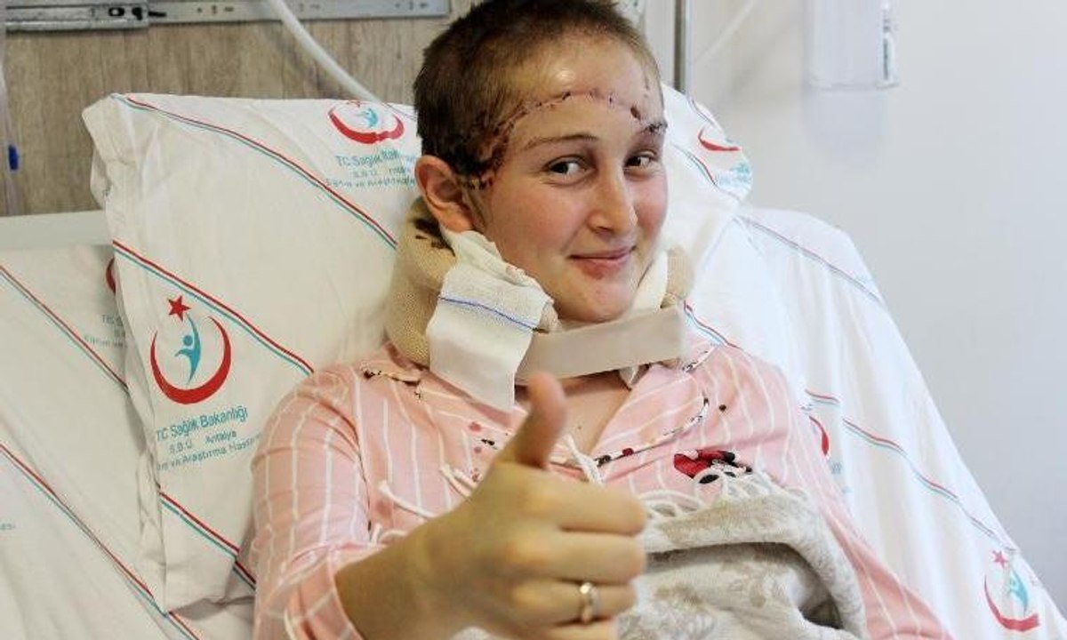 Kafa derisi kopan Binnaz, korku dolu anları anlattı