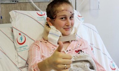 Kafa derisi kopan Binnaz, korku dolu anları anlattı