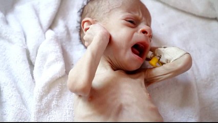 Yemen's warring sides meet face-to-face at Sweden peace talks