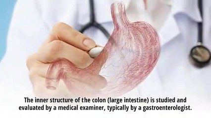 What is colonoscopy Treatment  - Viral Kumar Patel MD