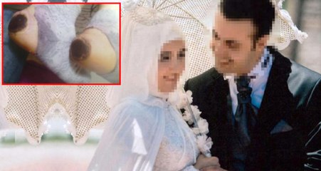 Doğumdan Çıkan Annenin Ayaklarını Yakan Hemşireler İçin Karar Verildi