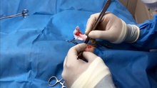 Cirurgia salva cachorro com cinomose