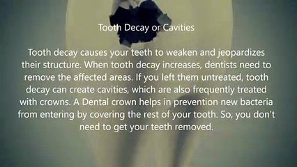 Reasons Why You Should Need a Dental Crown