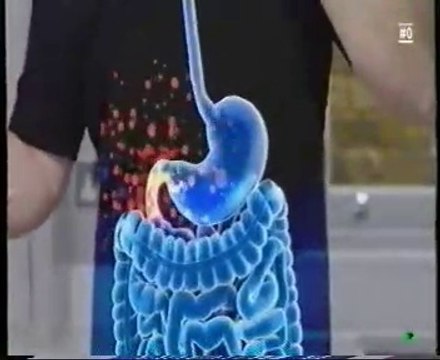 Carbohidratos y obesidad: Diabetes tipo II (Control de azucar mediante la dieta)