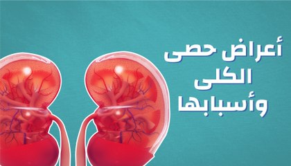 أعراض حصى الكلى وأسبابها