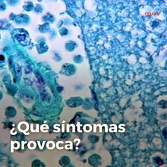 La ameba \'comecerebros\'