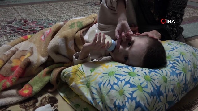 20 bin liralık ameliyatla sağlığına kavuşacak küçük çocuğun sessiz çığlığı...Hidrosefali hastası Mehmet'in ailesi yardım bekliyor