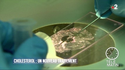 Santé - Cholestérol : un nouveau traitement
