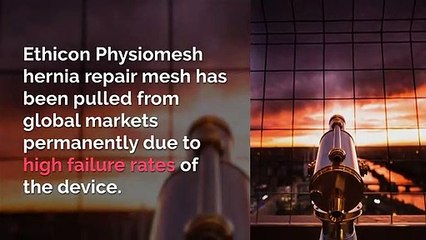 Physiomesh Attorneys In St. Louis