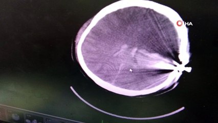 Esrarengiz olayı kafadaki bu mermi çözecek