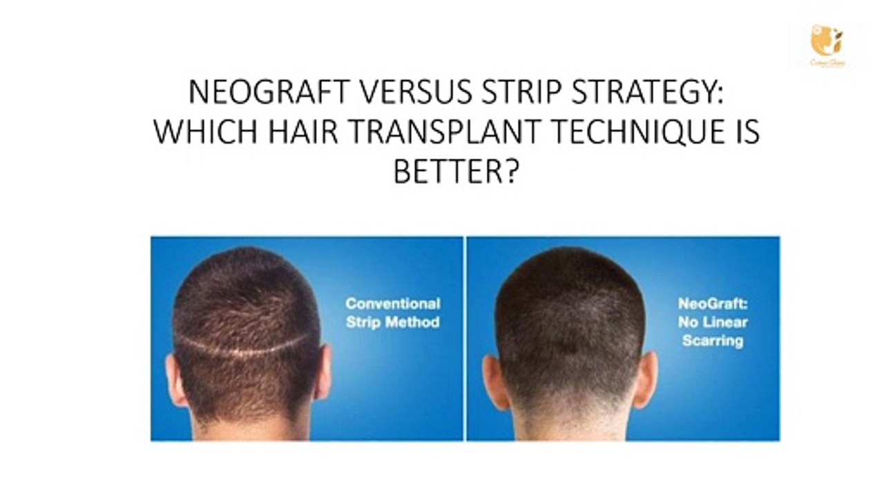 NEOGRAFT VERSUS STRIP STRATEGY