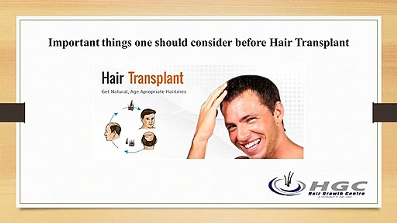 Important things one should consider before Hair Transplant