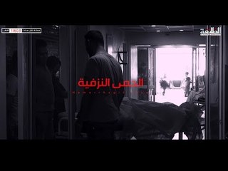 تشاهدون في الحلقة القادمة من برنامج حديث الشارع " مرض الحمى النزفية "